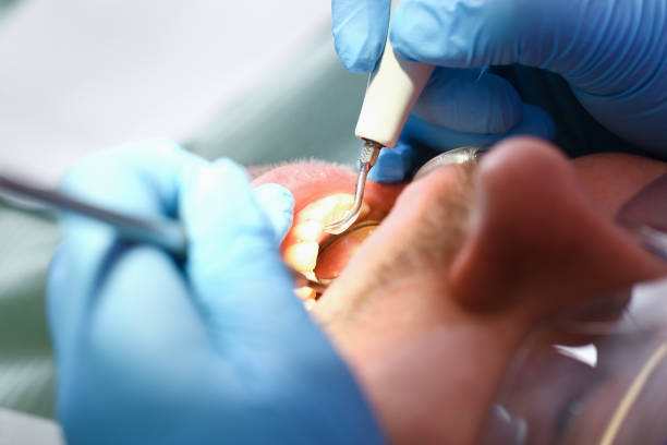 Best Emergency Gum Pain Relief  in Tulia, TX